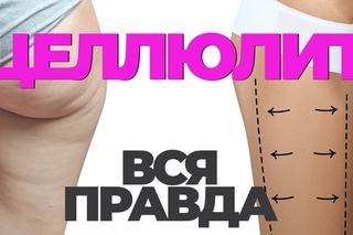Целлюлит: Вся правда о нем