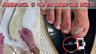 У девушки 46 размер ноги / Покажи это своим клиентам / Обувь по размеру Онихолизис причины