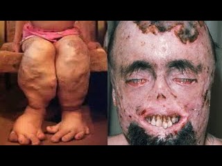 10 САМЫХ СТРАННЫХ БОЛЕЗНЕЙ