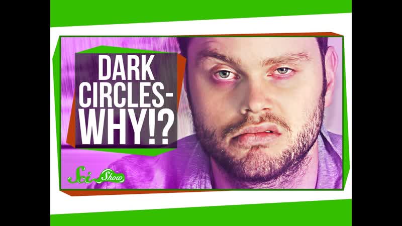 Why Do I Get Dark Circles Under My