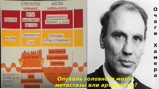 Опухоль головного мозга, метастазы в мозге или артефакты